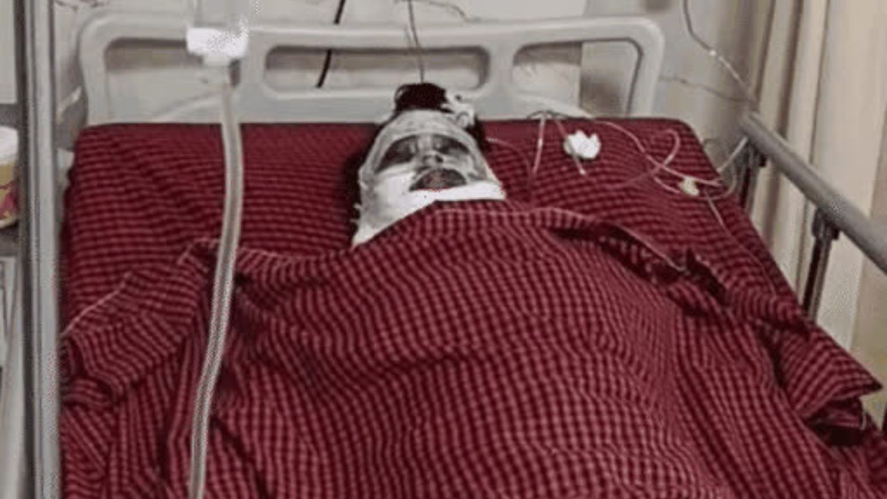 MP News: श्रद्धा पर एसिड फेंकने वाली इशिता गिरफ्तार, पुलिस ने खोले सनसनीखेज राज़, 45 फीसदी झुलसी पीड़िता